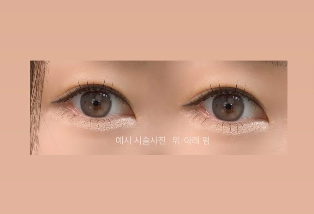 9a5a93d208dab60373fd313f3357d241_1761550644_9269.jpg 9a5a93d208dab60373fd313f3357d241_1761550